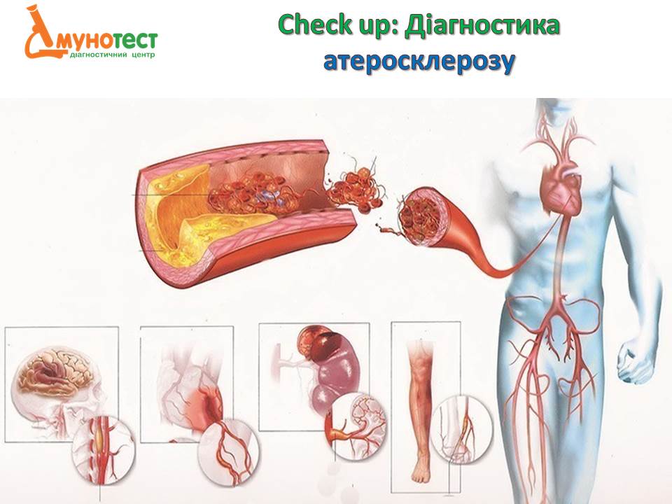 Лабораторія "ІМУНО ТЕСТ"